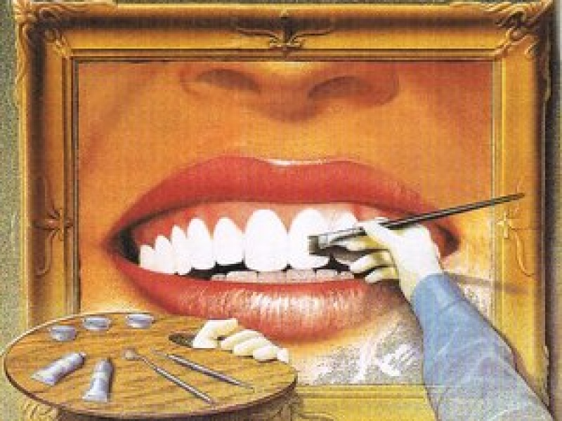 художественная реставрация зубов